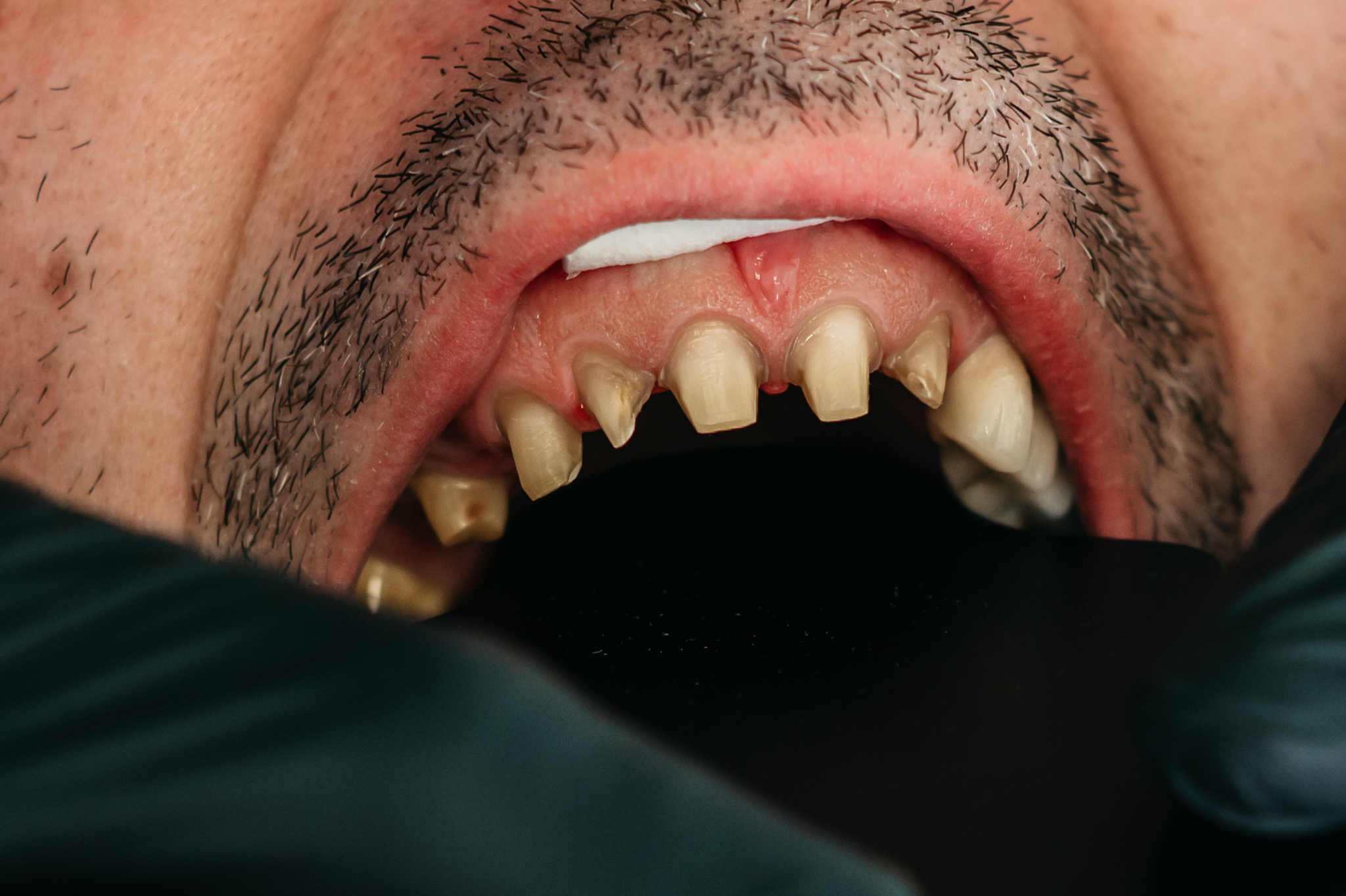 slika žene sa osmijehom