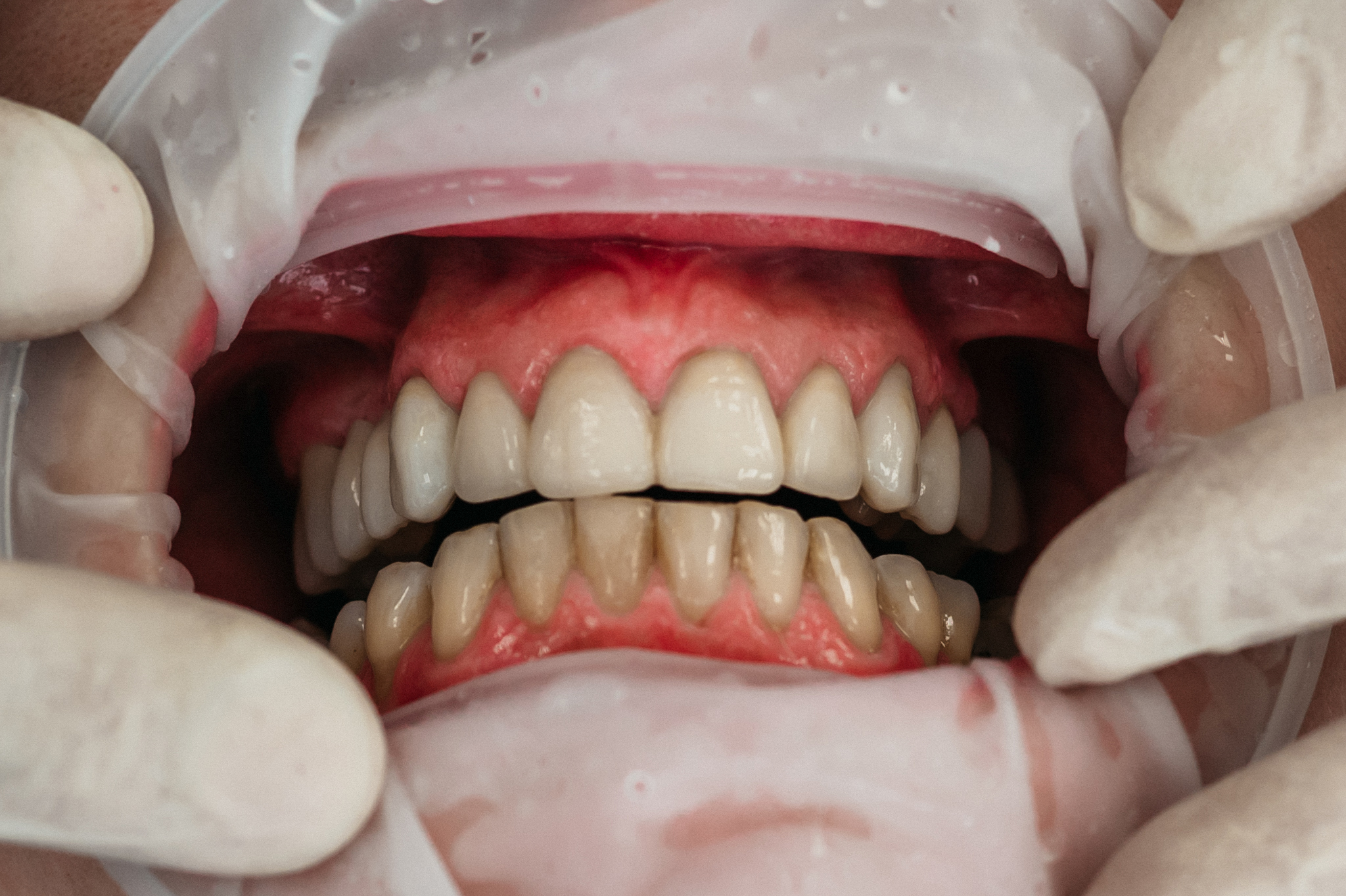 slika zubara u kutama